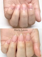 マリーロール 梅田店(Marie Laure)/自爪育成/深爪矯正/ネイルケア