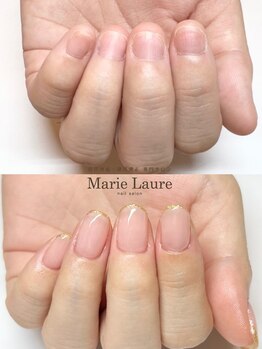 マリーロール 梅田店(Marie Laure)/自爪育成/深爪矯正/ネイルケア