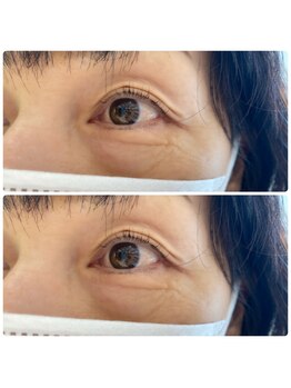 ジョリー(Jolie)/