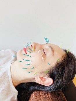 ダイエット×オーダーメイド整体/◎美容鍼灸×幹細胞培養液◎