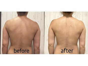 ニコ(25)/オーダーメイド筋膜リリース