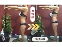 ルル(Lulu's)の雰囲気（脂肪ほぐし(週1回～2週に1回ペースで施術)）