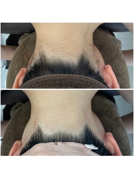 ミース 北九州店/うなじ●ビフォーアフター