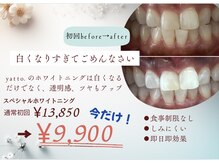 ヤット 森ノ宮(yatto.)/春までの期間限定特別価格！