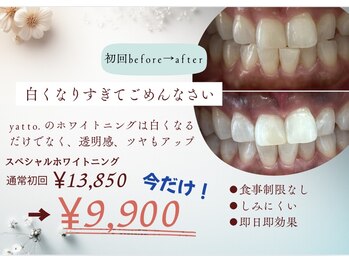 ヤット 森ノ宮(yatto.)/春までの期間限定特別価格！