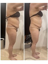 ありひ/セルゼロの効果！！