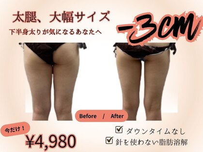 ソルニス(Solnis.)の写真