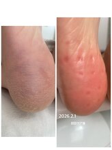 フットネイル　お任せください