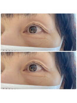 ジョリー(Jolie)/