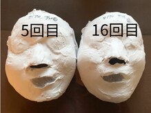 パール/石膏パックのビフォーアフター