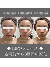 ナンバーファイブクリニカルサロン 札幌店(No.5)/BeforeAfter/施術後から変化