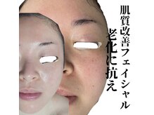 ハーブスキン(herb skin)の雰囲気（札幌実力サロン♪リアボーテ肌質改善ニキビケア・乾燥赤身ケア）