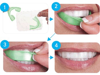 エクシアホワイトニング 日本橋店/ホームホワイトニング