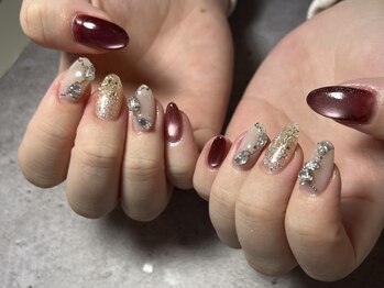 イデアル(Ideal)/【パラジェル】定額Ｍコース