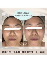 HBS-WA整体/筋膜リリース顔＋頭筋膜リリース