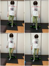 幸鍼灸整体院 武庫之荘院/整体・トレーニング・姿勢変化10