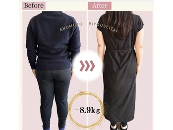 えのもと美容整体院/30代女性