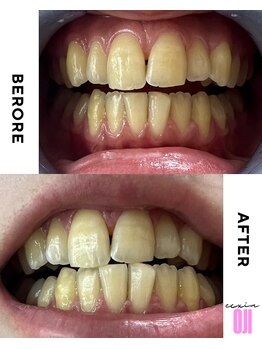 エクシアホワイトニング 王寺店/