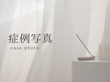 ハーブピーリング&フェイシャルサロン シーベル 福岡天神/症例写真/ハーブピーリング