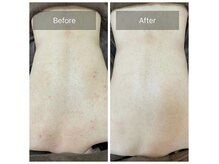 エミルカ 天王寺店(EMILUCA)の雰囲気（自社開発のハーブピーリングで回数を重ねるたびに理想のお肌へ！）