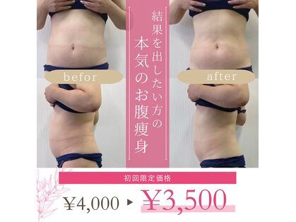 米子美人の写真