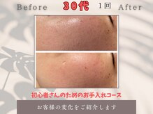 トータルビューティー雅/お肌のキメ整います！