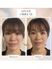 【新規】大人気！顔を触らない小顔矯正40分|むくみ・たるみ改善 ¥7000→¥6300