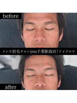 ユー 千葉駅前店(you)/ビフォ－アフター写真