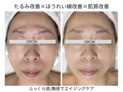 グロウ バイ フェイシャルデザイン アンド アイ(GROW)の写真