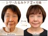 【たるみ・しわ徹底ケア】写真映え! たるみ・しわ90分プラン¥16400→¥9800