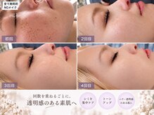 B.B藤沢 レオスタイル(LeoStyle)の雰囲気（気になるシミを集中ケア。回数を重ねて透明感あふれる素肌へ導き）