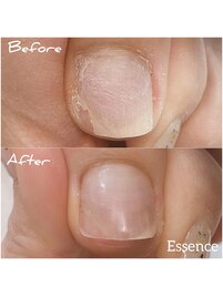 足爪リペア(親指 1,850yenから)