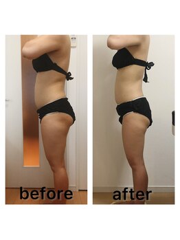 ルフレ(Rufle)/充実コースビフォーアフター