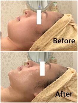 スペチアーレ 夙川/人生100年時代のお顔貯金