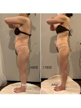 ソウソウビューティー 五反田(Shou Shou Beauty)/施術4回→17回