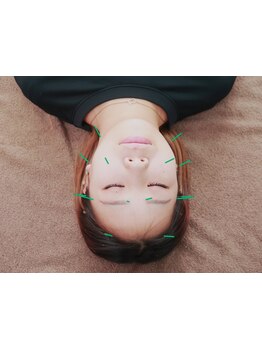 鍼灸施術を受けたい