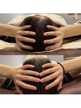 ビポルテ(BPORTE)/ドライヘッドスパ