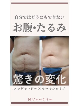 Nビューティー/最新エンダモロジーBODY