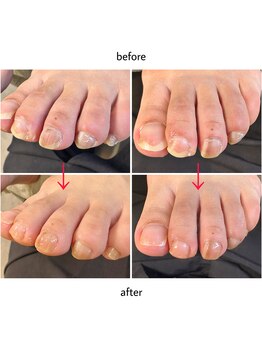 ケアプラス(care plus)/フットネイルケア