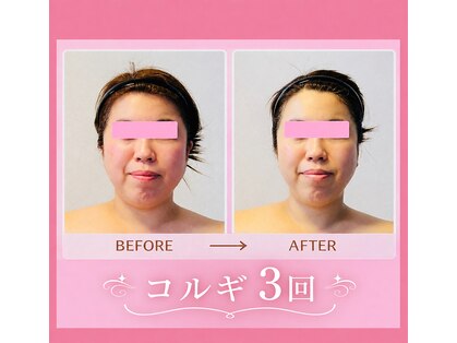 蓮(HASU)の写真