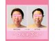 蓮(HASU)の写真