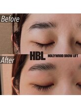 オルト(Orto)/ハリウッドブロウリフト