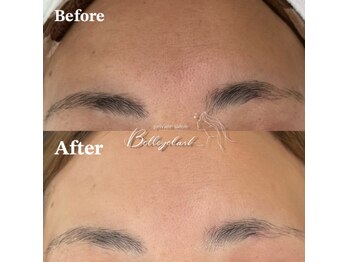 ベルアイラッシュ(Belleyelash)/【フェイシャルワックス】