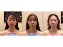 アジール 新潟市(agir)/Before/After 