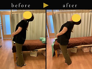 杉本接骨鍼灸院/説明がとても分かりやすかった