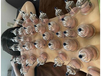 カンナム整体院/カッピング+プレミアム整体60分