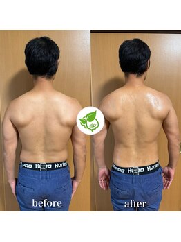 カイロプラクティック ネクサス/背中の歪みとむくみ撃退☆