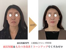 エソア(esoa)の雰囲気（眠れるほど優しい施術で骨格から根本改善！面長短縮ならesoaへ！）