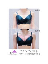 バイオビューティー 神戸本店(Bio Beauty)/プランプバスト 体験コース症例