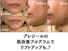 プレジール(plaisir)の雰囲気(美肌も小顔も叶います)
